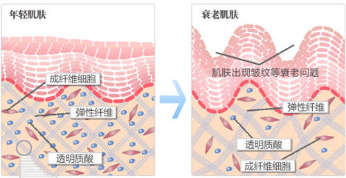 有研究表明,皮肤衰老过程,就是真皮层胶原蛋白流失的过程!